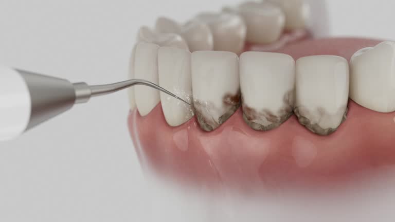 Trusted Emergency Dentist service in White Oak, OH - Dentist Open Now